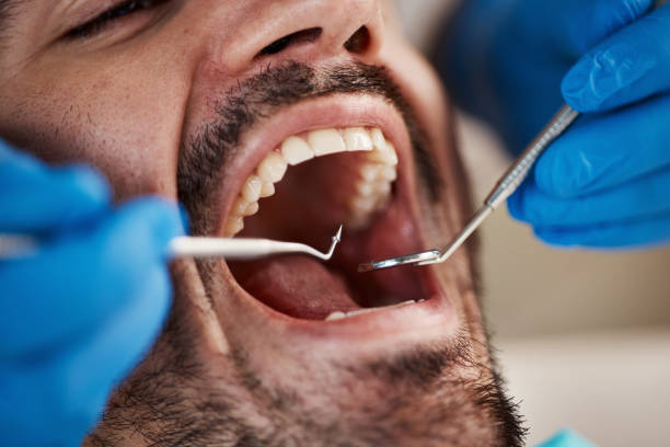 Best Knocked-Out Tooth Emergency  in Dublin, PA